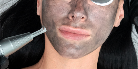 Hollywood Peel 4