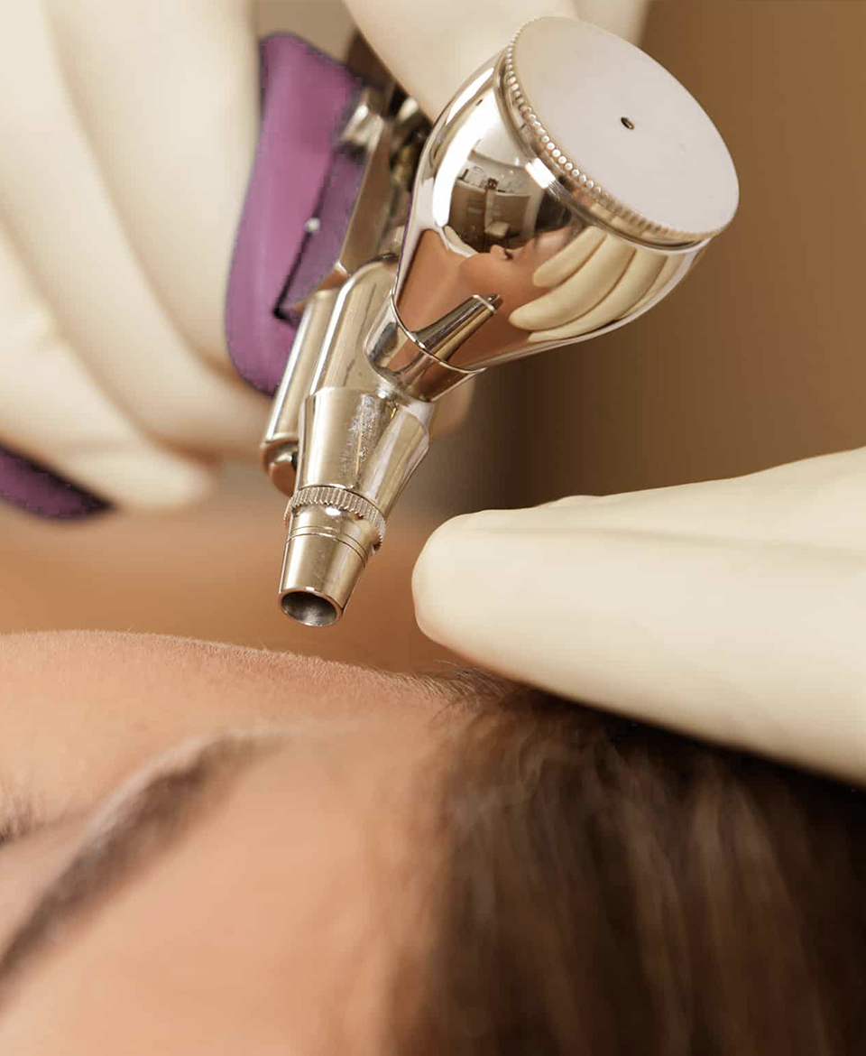 Oxy Facial 5