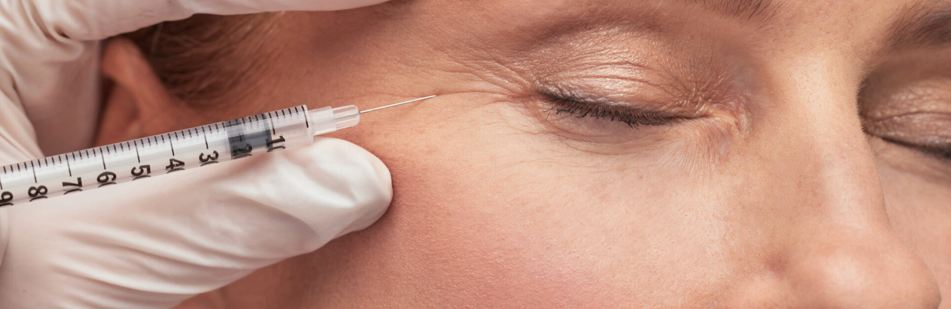 Botox