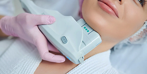 Ultherapy1