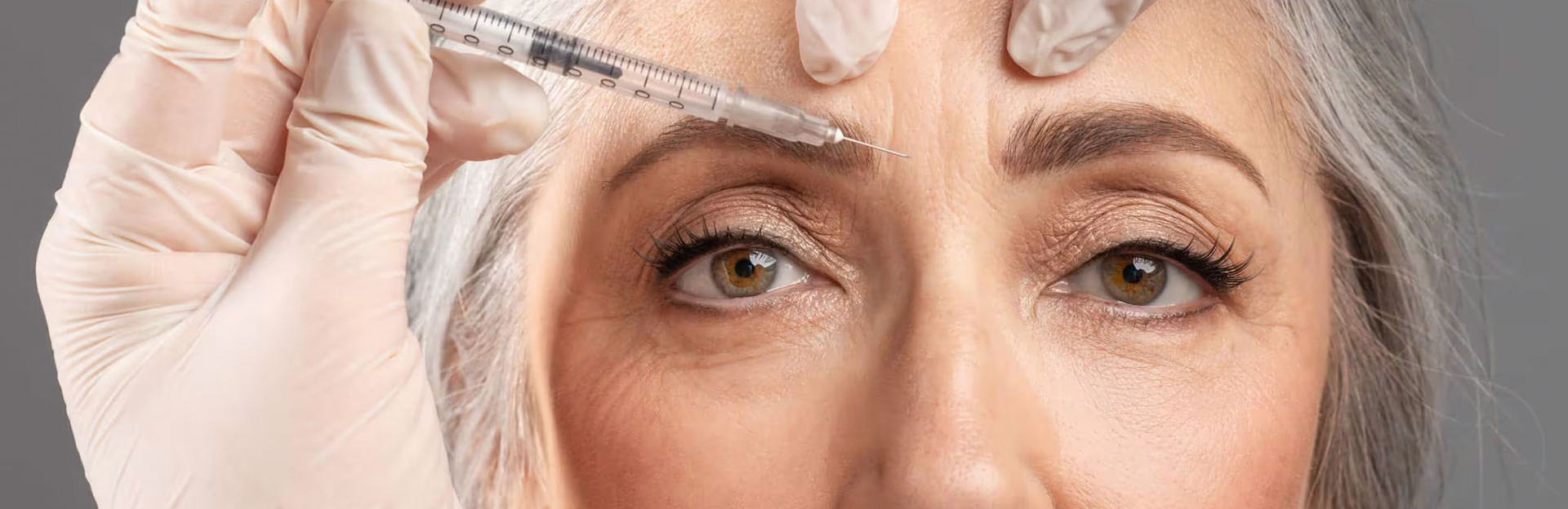 bioestimulación banner