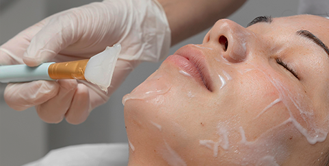 peeling4