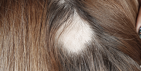 pelo 4
