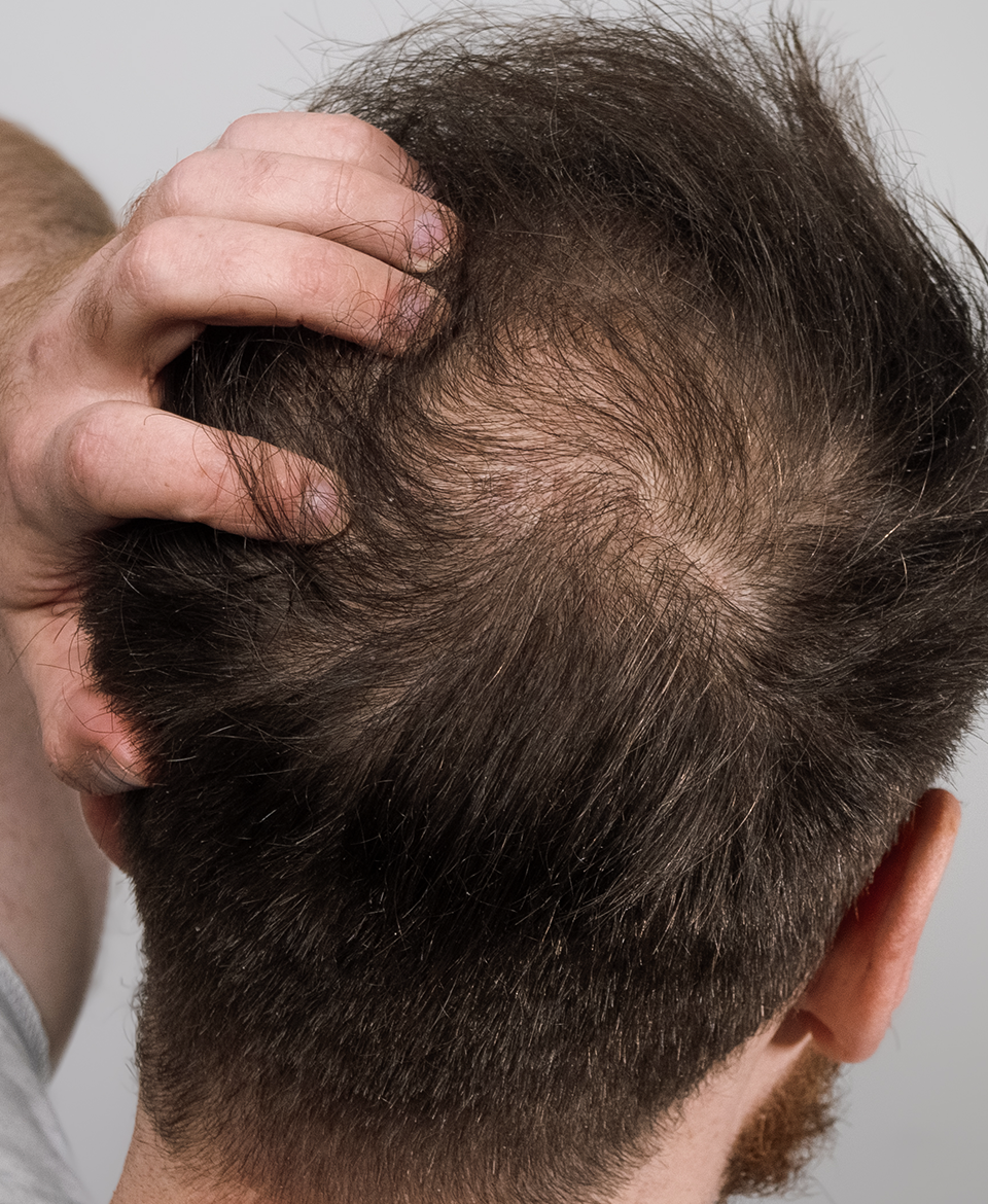 pelo 5