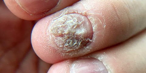 uñas 1