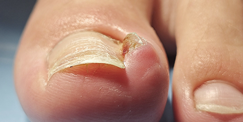 uñas 2