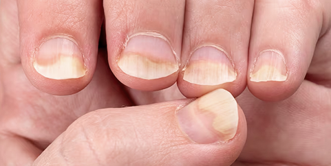 uñas 3