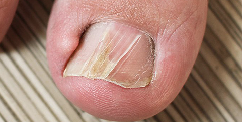 uñas 4